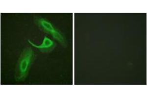 Immunofluorescence analysis of HeLa cells, using CD18/ITGB2 (Ab-758) Antibody. (Integrin beta 2 antibody  (AA 720-769))