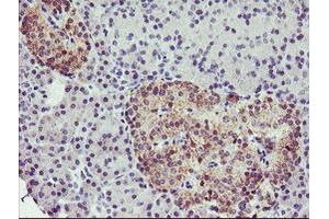 Immunohistochemical staining of paraffin-embedded Human pancreas tissue using anti-TMOD1 mouse monoclonal antibody. (Tropomodulin 1 antibody)