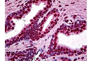 Anti-MEF2A antibody IHC of human prostate. (MEF2A antibody  (AA 71-170))