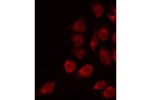 ABIN6275382 staining COLO205 by IF/ICC. (Kcng2 antibody  (Internal Region))