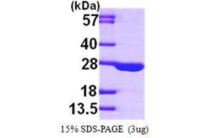 SDS-PAGE (SDS) image for Adenylate Kinase 1 (AK1) (AA 1-194) protein (His tag) (ABIN667254) (Adenylate Kinase 1 Protein (AK1) (AA 1-194) (His tag))