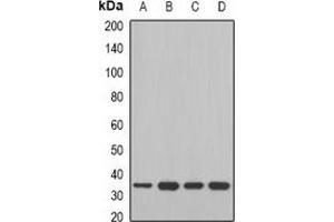 Western blot analysis of MDH2 expression in Jurkat (A), A549 (B), mouse liver (C), mouse heart (D) whole cell lysates. (MDH2 antibody)