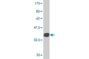 Western Blot detection against Immunogen (36. (ZIC2 antibody  (AA 130-220))