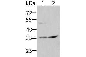 Western Blot analysis of HT-29 and 231 cell using SOCS1 Polyclonal Antibody at dilution of 1:1700 (SOCS1 antibody)