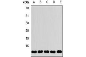 Western blot analysis of FKBP2 expression in MCF7 (A), SKOV3 (B), Jurkat (C), mouse liver (D), mouse brain (E) whole cell lysates.