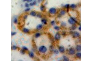 Used in DAB staining on fromalin fixed paraffin-embedded Liver tissue (NOD1 antibody  (AA 612-826))