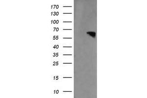 Image no. 1 for anti-Rhotekin (RTKN) antibody (ABIN1500702) (Rhotekin antibody)