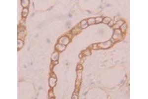 IHC-P analysis of Human Tissue, with DAB staining. (SLC39A6 antibody  (AA 29-325))