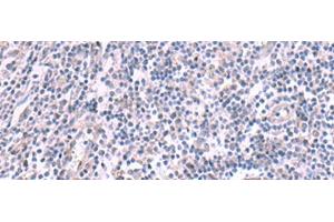 Immunohistochemistry of paraffin-embedded Human tonsil tissue using KCNK10 Polyclonal Antibody at dilution of 1:45(x200)