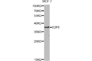 Western blot analysis of extracts of MCF-7 cells, using E2F6 antibody (ABIN6290326) at 1:1000 dilution.