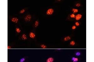 Immunofluorescence analysis of NIH/3T3 cells using TriMethyl-Histone H3-K64 Polyclonal Antibody at dilution of 1:100. (Histone 3 antibody  (3meLys64))