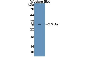 Detection of Recombinant IL17D, Rat using Polyclonal Antibody to Interleukin 17D (IL17D) (IL17D antibody  (AA 76-274))