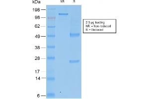 SDS-PAGE Analysis Purified TIMP2 Mouse Recombinant Monoclonal Antibody (rTIMP2/2335). (Recombinant TIMP2 antibody  (N-Term))