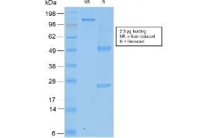 SDS-PAGE Analysis Purified TIMP2 Mouse Recombinant Monoclonal Antibody (rTIMP2/2335).
