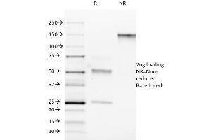 SDS-PAGE Analysis Purified ROR-gamma / RORC Mouse Monoclonal Antibody (RORC/2942). (RORC antibody)