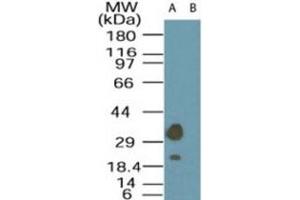 Western blot analysis of LYK5 in A-549 cell lysate in the (A) absence and (B) presence of immunizing peptide using LYK5 polyclonal antibody  at 1 ug/mL . (STRADA antibody  (AA 300-350))