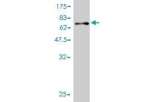 Western Blot detection against Immunogen (71. (PSMC4 antibody  (AA 1-418))