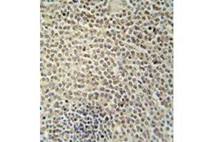 Formalin fixed, paraffin embedded human spleen tissue stained with RBMX2 Antibody (C-term) followed by peroxidase conjugation of the secondary antibody and DAB staining. (RBMX2 antibody  (C-Term))