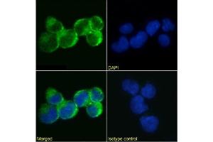 Immunofluorescence staining of Jurkat cells using anti-IL-9R antibody AH9R2. (Recombinant IL9 Receptor antibody)