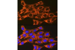 Immunofluorescence analysis of C6 cells using UQCRFS1 Rabbit mAb (ABIN7271127) at dilution of 1:100 (40x lens). (UQCRFS1 antibody)