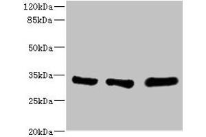 Western blot All lanes: EIF2B1 antibody at 5. (EIF2B1 antibody  (AA 1-305))