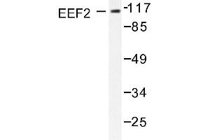 Image no. 1 for anti-Eukaryotic Translation Elongation Factor 2 (EEF2) antibody (ABIN265392) (EEF2 antibody)