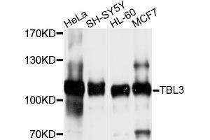 Western blot analysis of extracts of various cell lines, using TBL3 antibody (ABIN4905375) at 1:1000 dilution.