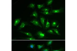 Immunofluorescence analysis of HepG2 cells using CD46 Polyclonal Antibody (CD46 antibody)