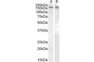 ABIN334355 (0. (AVPR1B antibody  (Internal Region))