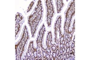 IHC analysis of AHR using anti-AHR antibody (ABIN6719265). (Aryl Hydrocarbon Receptor antibody)