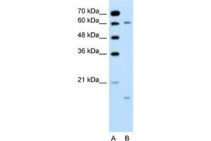 Western Blotting (WB) image for anti-Cytochrome P450, Family 4, Subfamily A, Polypeptide 22 (CYP4A22) antibody (ABIN2462485) (CYP4A22 antibody)