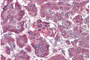 Pancreas, Human: Formalin-Fixed, Paraffin-Embedded (FFPE) (CCR4 antibody  (Extracellular Domain))