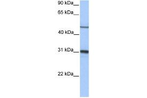 WB Suggested Anti-EPHX1 Antibody Titration: 0. (EPHX1 antibody  (Middle Region))