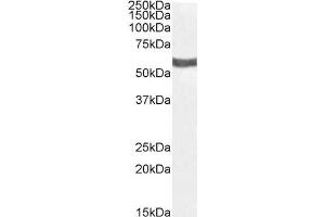 Western Blotting (WB) image for anti-Purinergic Receptor P2X, Ligand-Gated Ion Channel, 4 (P2RX4) (C-Term) antibody (ABIN334455)