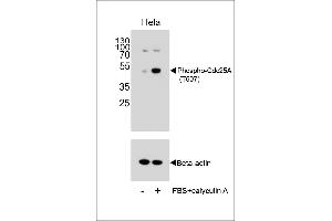 Western blot analysis of extracts from Hela cells, untreated or treated with calyculin A, using Phospho-Cdc25A Antibody . (CDC25A antibody  (pThr507))