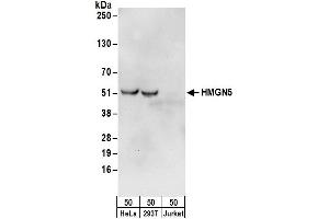 anti-High Mobility Group Nucleosome Binding Domain 5 (HMGN5) (AA 232-282) antibody