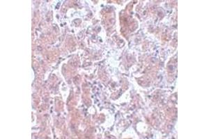 Immunohistochemistry (IHC) image for anti-ELOVL Fatty Acid Elongase 7 (ELOVL7) (N-Term) antibody (ABIN1031366)