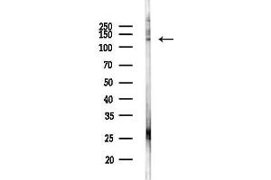 anti-Janus Kinase 2 (JAK2) (pTyr931) antibody