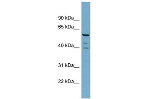 RABGEF1 antibody used at 1 ug/ml to detect target protein. (RABGEF1 antibody)