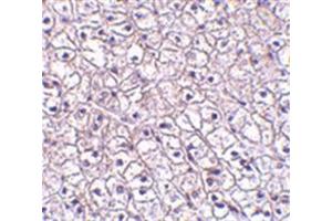 Image no. 1 for anti-Cytokine Receptor-Like Factor 2 (CRLF2) (Middle Region) antibody (ABIN318884) (CRLF2 antibody  (Middle Region))
