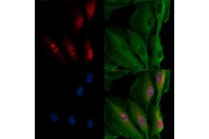 ABIN7094490 and ABIN7098539 staining  cells by IF/ICC.