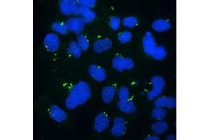 anti-Golgi phosphoprotein 3 (Coat-Protein) (GOLPH3) (AA 56-298) antibody