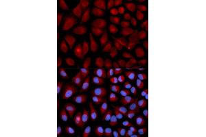 Immunofluorescence (IF) image for anti-Vimentin (VIM) (AA 1-200) antibody (ABIN3016292) (Vimentin antibody  (AA 1-200))