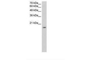 ZNF580 Antikörper  (AA 31-80)