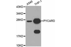 Western blot analysis of extracts of various cell lines, using PYCARD antibody (ABIN4904914) at 1:1000 dilution. (PYCARD antibody)