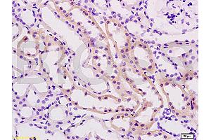 Formalin-fixed and paraffin embedded rat kidney tissue labeled with Anti-TIMP-2 Polyclonal Antibody (ABIN668346), Unconjugated at 1:200, followed by conjugation to the secondary antibody and DAB staining (TIMP2 antibody  (AA 131-220))