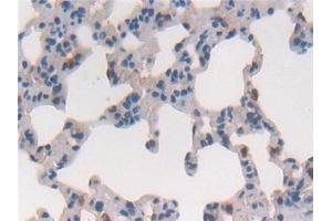 Detection of CYGB in Rat Lung Tissue using Polyclonal Antibody to Cytoglobin (CYGB)