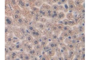 Detection of MIP1b in Mouse Liver Tissue using Polyclonal Antibody to Macrophage Inflammatory Protein 1 Beta (MIP1b) (CCL4 antibody  (AA 24-92))