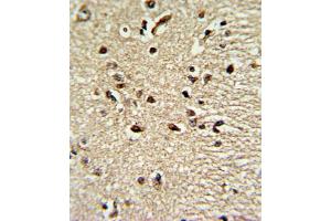 Immunohistochemistry (IHC) image for anti-Paired Box 4 (PAX4) antibody (ABIN3002750) (PAX4 antibody)