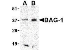 Western Blotting (WB) image for anti-BCL2-Associated Athanogene (BAG1) (C-Term) antibody (ABIN2477576) (BAG1 antibody  (C-Term))